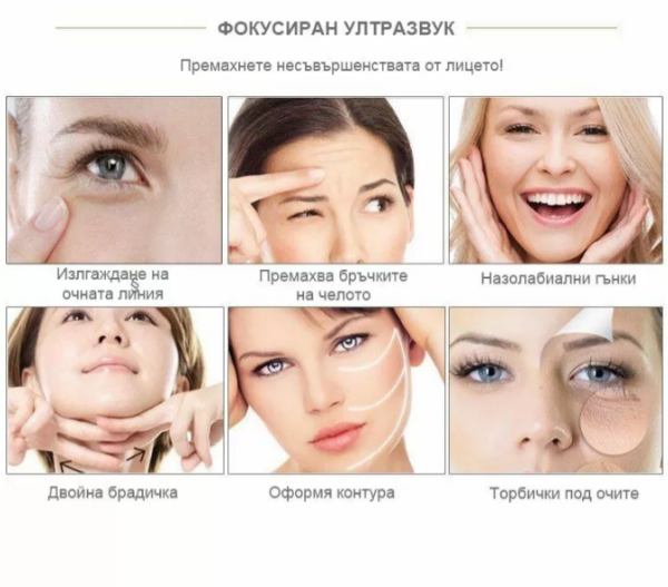 Skin lifting and rejuvenation - V-Max HIFU device - Image 10